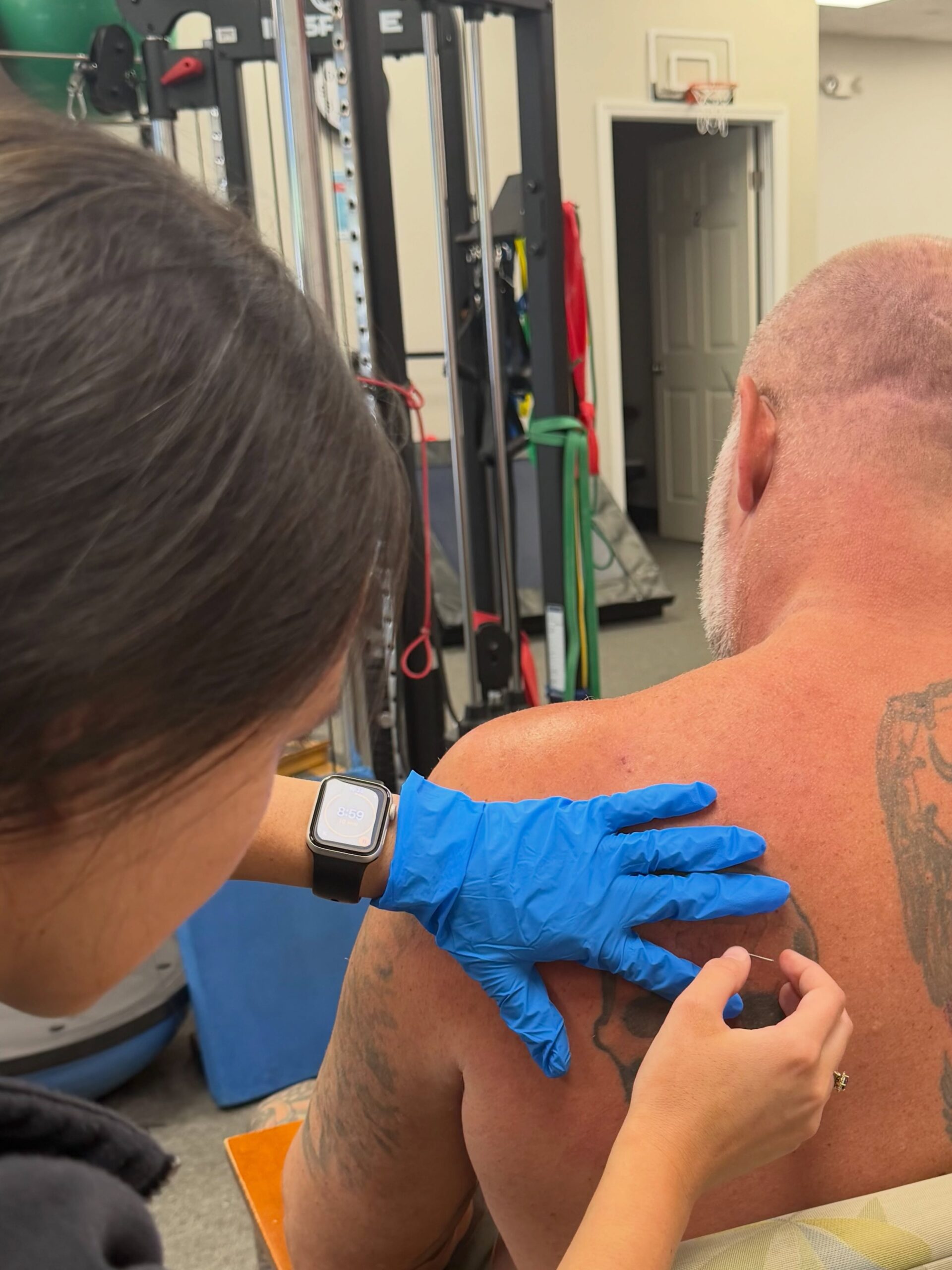 The dog days are over. ✨

Dry needling is now offered at our Mount Pleasant and West Ashley location!

#RehabCarolina #DryNeedling #PhysicalTherapy #MountPleasantSC #WestAshley CharlestonSC